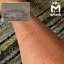 Пассажирка обожгла ногу в автобусе в 30-градусную жару