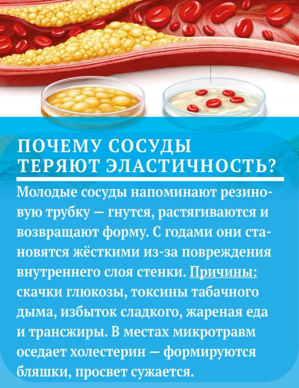 Что поможет сохранить сосуды здоровыми и эластичными Что поможет сохранить сосуды здоровыми и эластичными