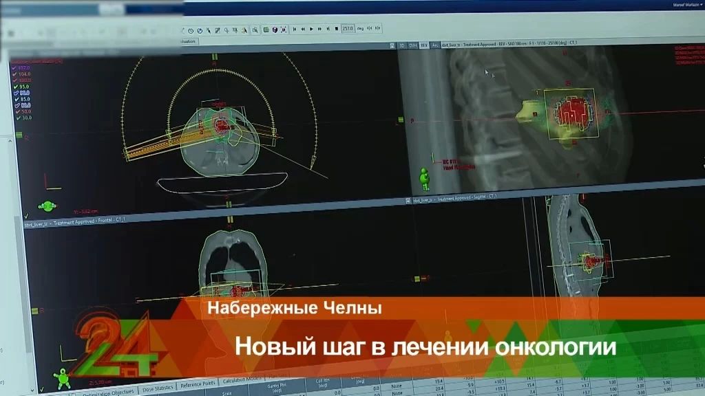 Врачи Набережных Челнов впервые применили новый метод лечения метастаза в печени