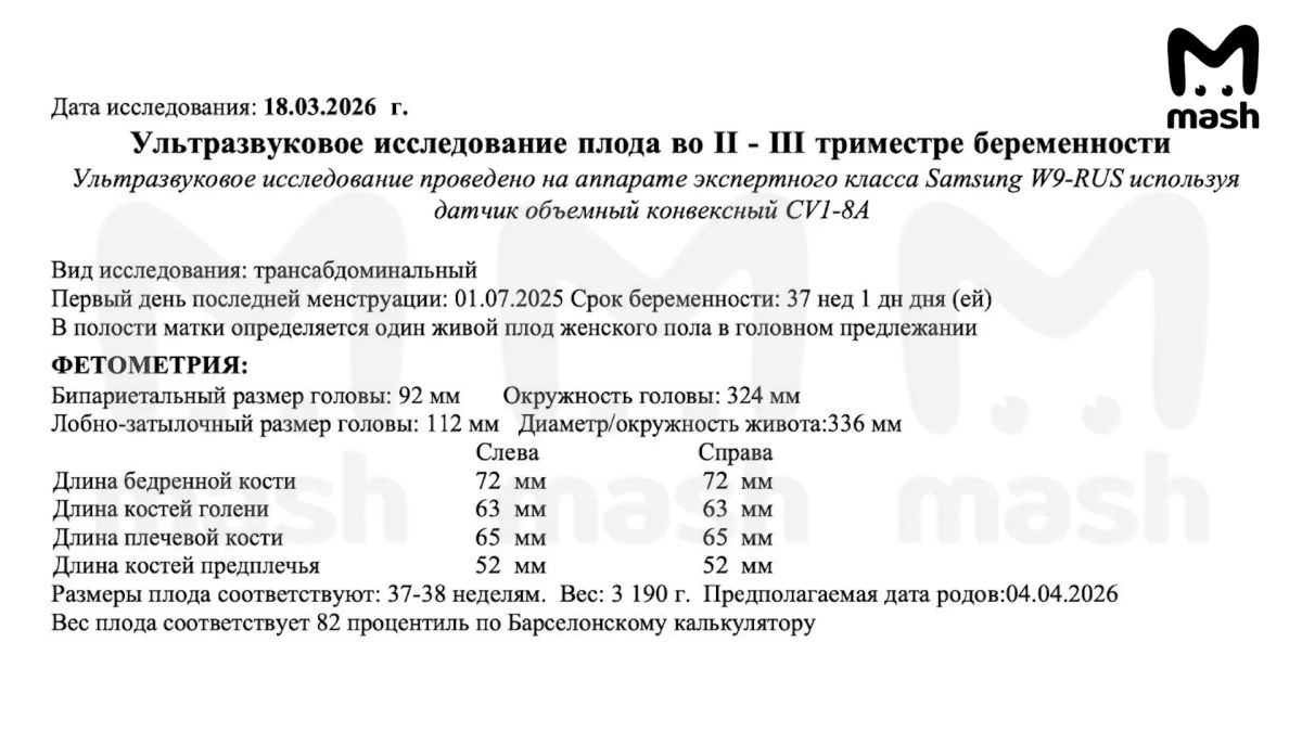 У женщины из Казани родился ребёнок с врождёнными патологиями позвоночника и рёбер У женщины из Казани родился ребёнок с врождёнными патологиями позвоночника и рёбер