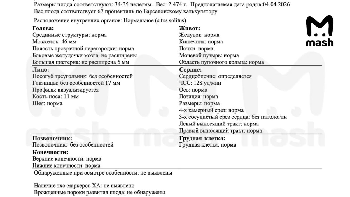 У женщины из Казани родился ребёнок с врождёнными патологиями позвоночника и рёбер У женщины из Казани родился ребёнок с врождёнными патологиями позвоночника и рёбер